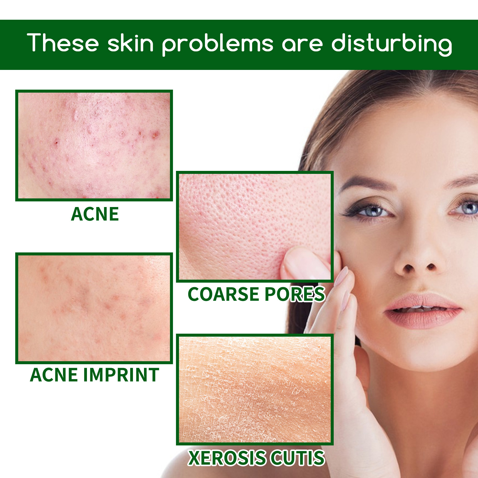 Salicylic Acid Anti Acn-e Face - огляд і ціна Glycolic Acid Exfoliant