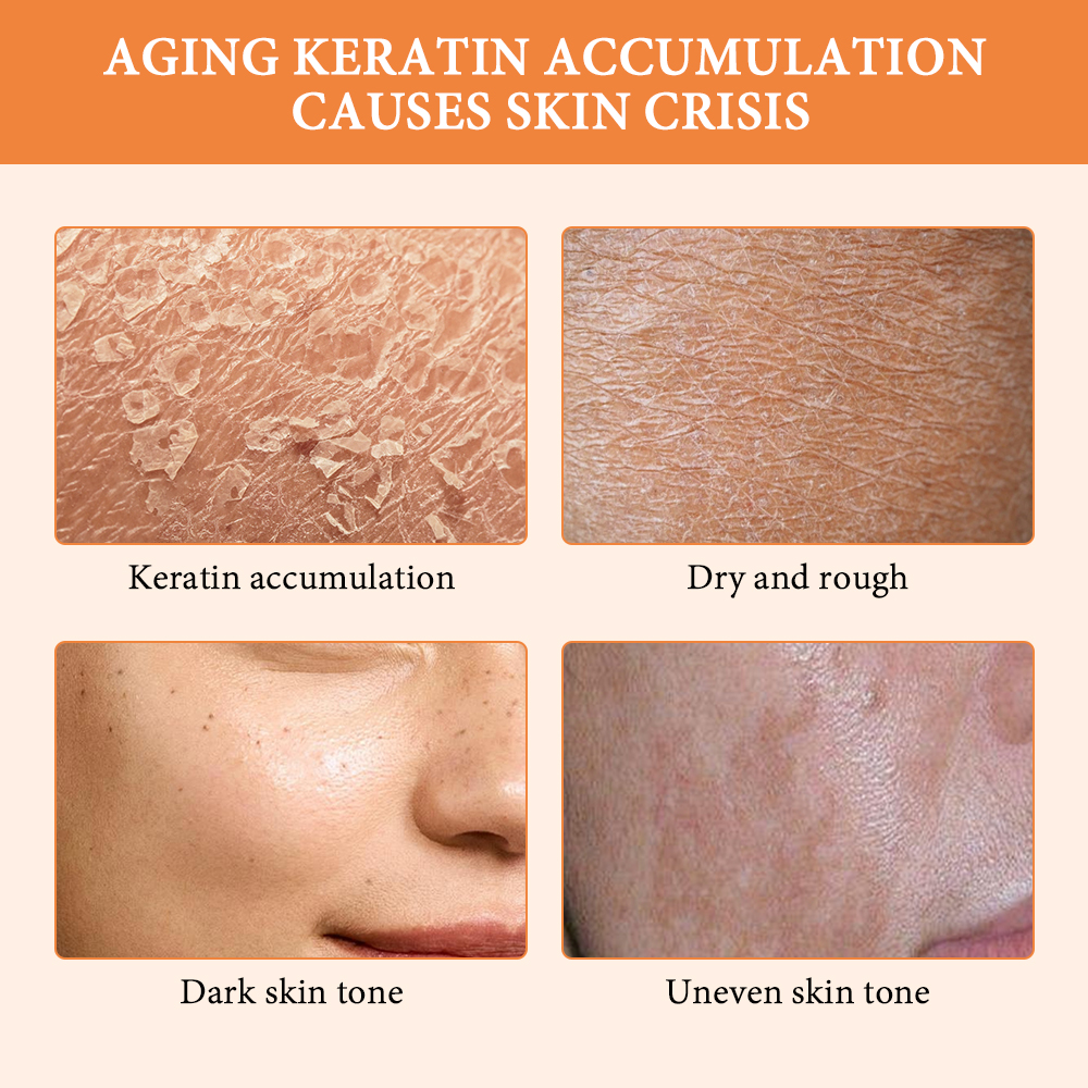 Orange Peeling Gel Scrub For B - огляд і ціна Glycolic Acid Exfoliant
