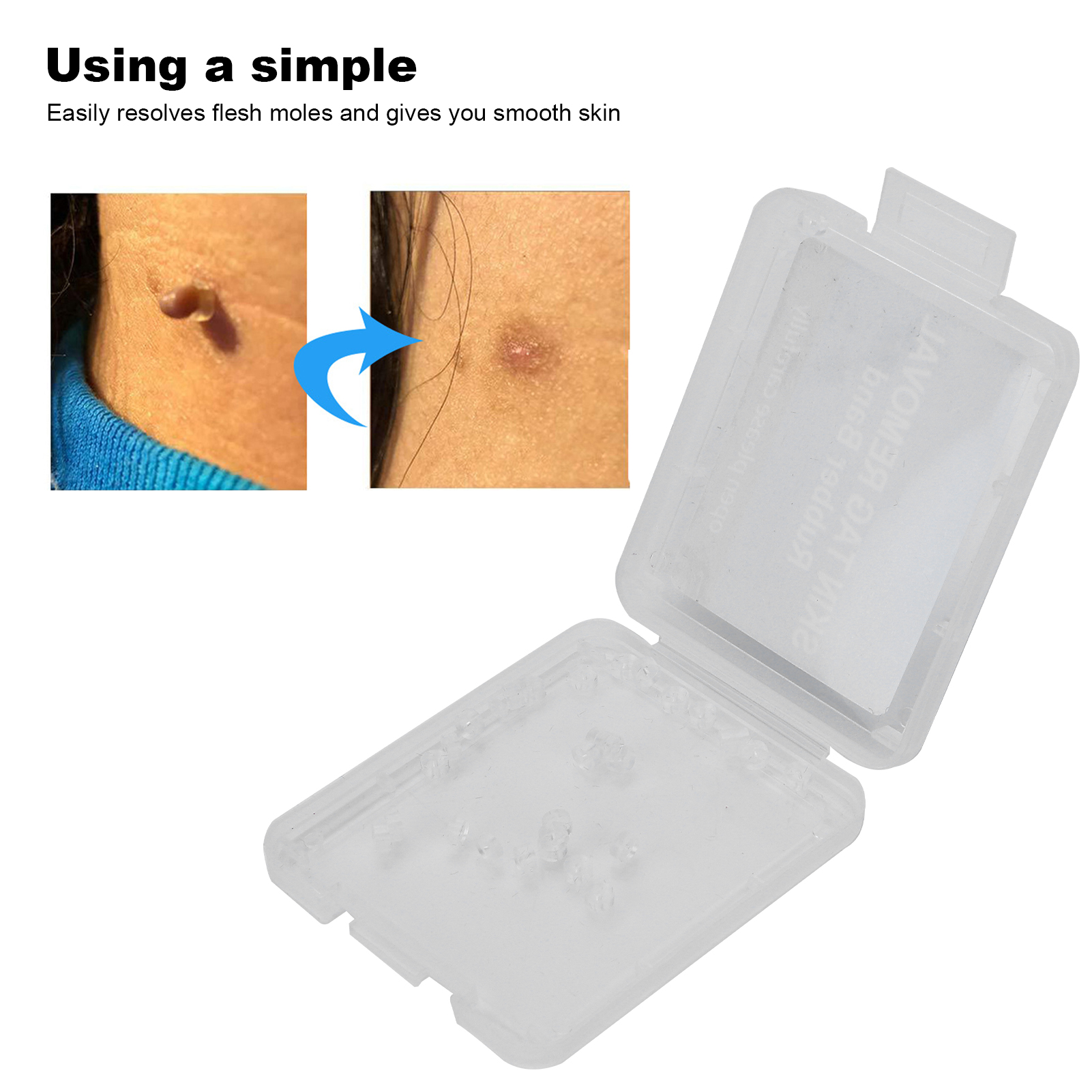 30Pcs Painless Skin Tag Remova - огляд і ціна Skincare Ingredients Checker