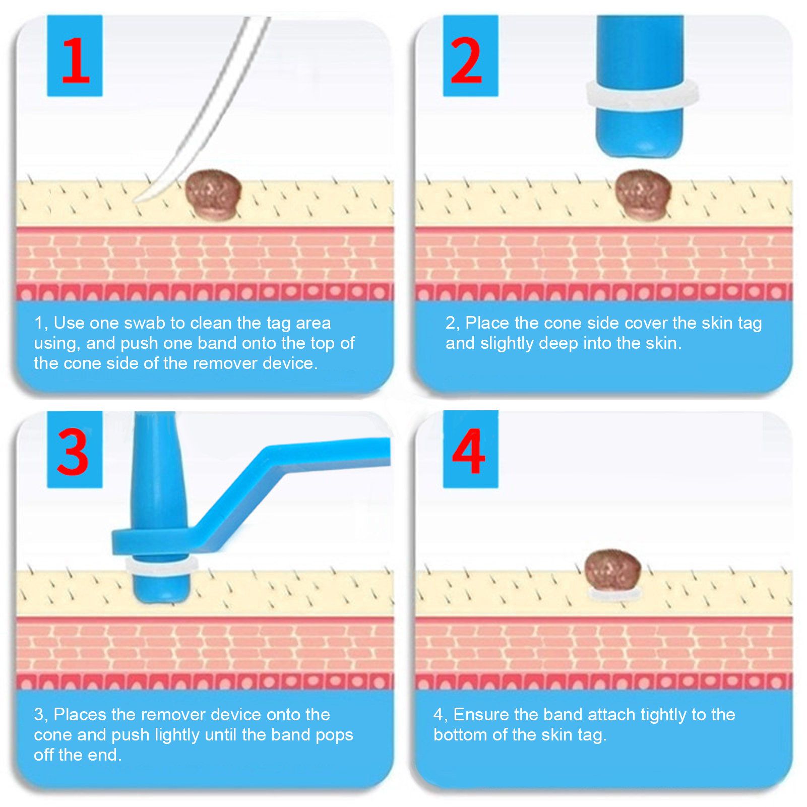 30Pcs Painless Skin Tag Remova - огляд і ціна Skincare Ingredients Checker