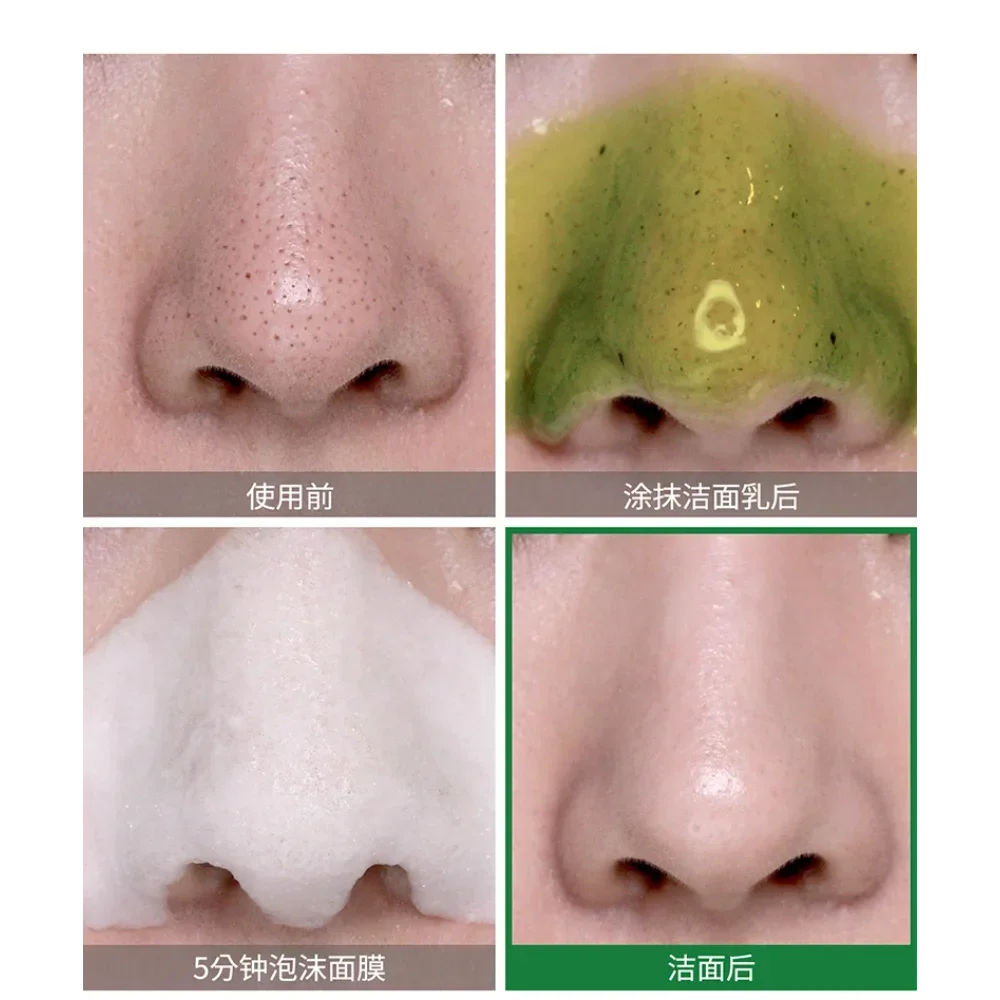Korea SOME BY MI Bye Bye Black - огляд і ціна Skincare Some By Mi