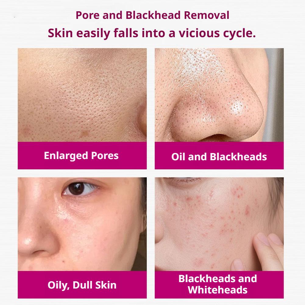 Salicylic Acid Shrink Pores Se - огляд і ціна Glycolic Acid Exfoliant