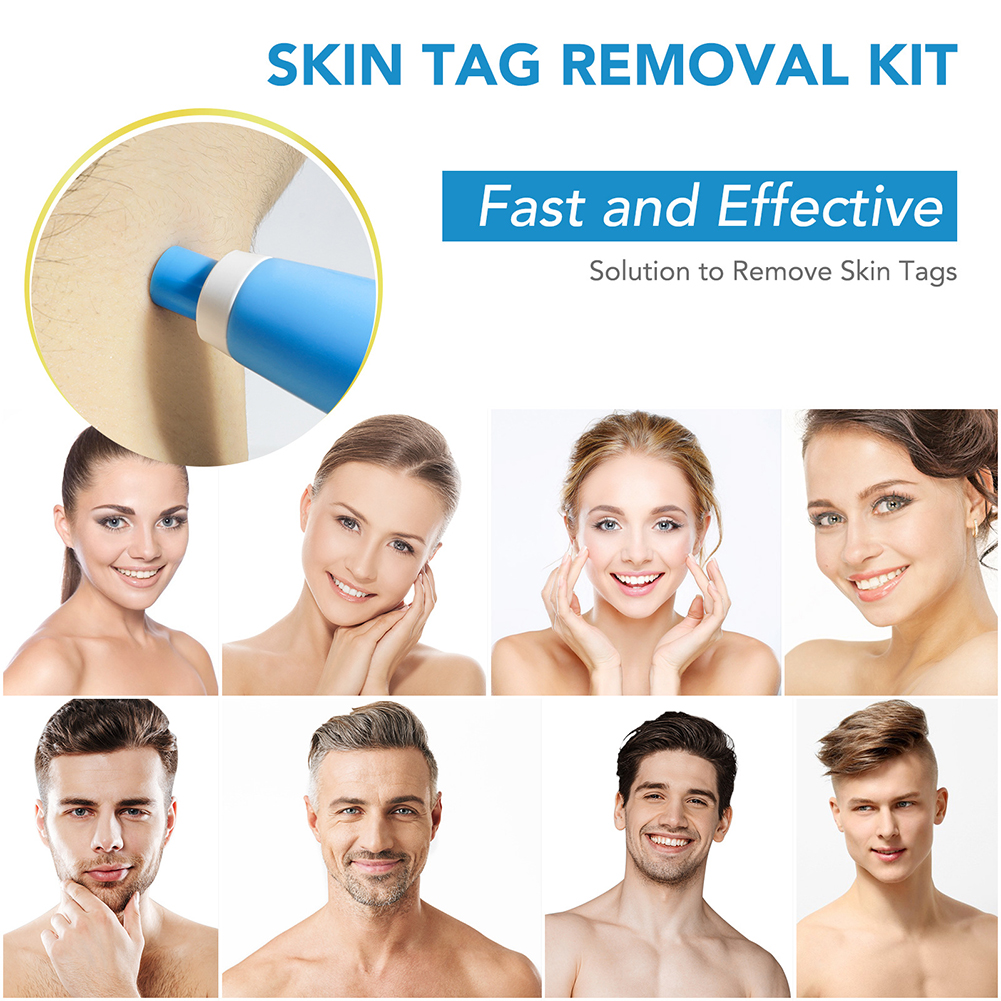 2-IN-1 Auto Skin Tag Removal K - огляд і ціна Skincare Ingredients Checker