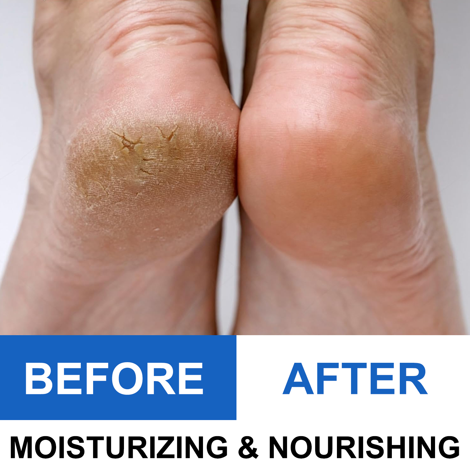 40% Urea Foot Cream Stick - Mo - огляд і ціна Glycolic Acid Exfoliant